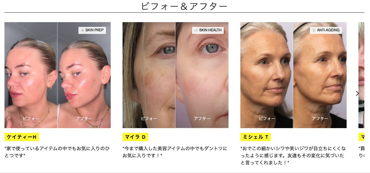 【EMSが美顔に良いらしい】ZIIP HALO(ジップ ハロ)美顔器の効果・口コミを見ていく!